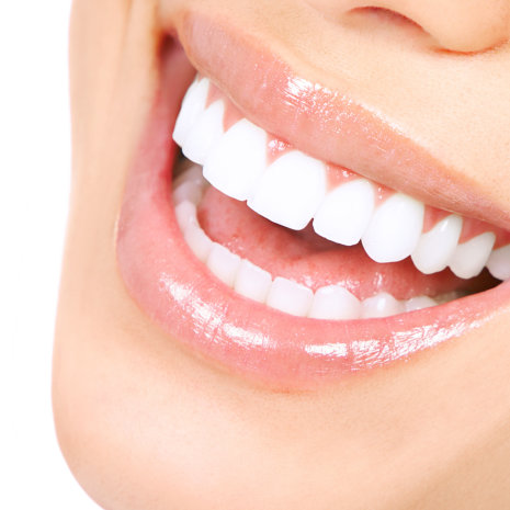 Matthews Dental Associates - Dr. Dan Matthews DMD - Dr. Bruce Matthews DDS - Dr. Katie Matthews DDS - Veneers and Laminates Matthews Dental Associates - Dr. Dan Matthews DMD - Dr. Bruce Matthews DDS - Dr. Katie Matthews DDS - Veneers and Laminates